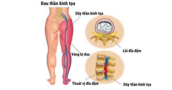 dau-cot-song-that-lung-9