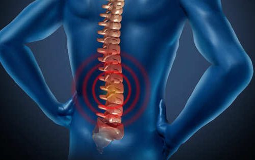 Thoái hóa cột sống lưng: Nguyên nhân và cách điều trị