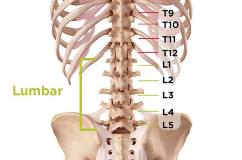 Đau cột sống thắt lưng - Dụng cụ giảm đau lưng tốt nhất